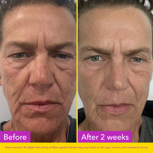 Load image into Gallery viewer, Copper Peptide Serum with PDRN
